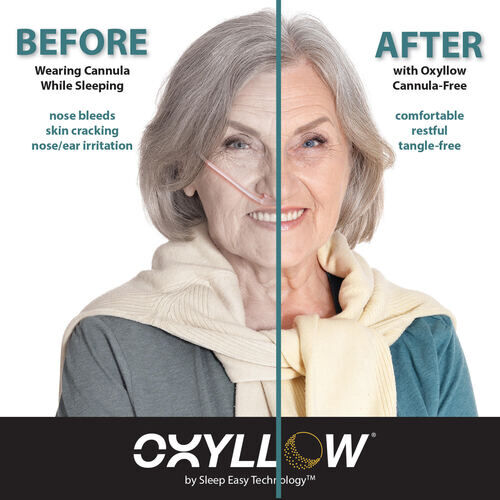 The Oxyllow® System